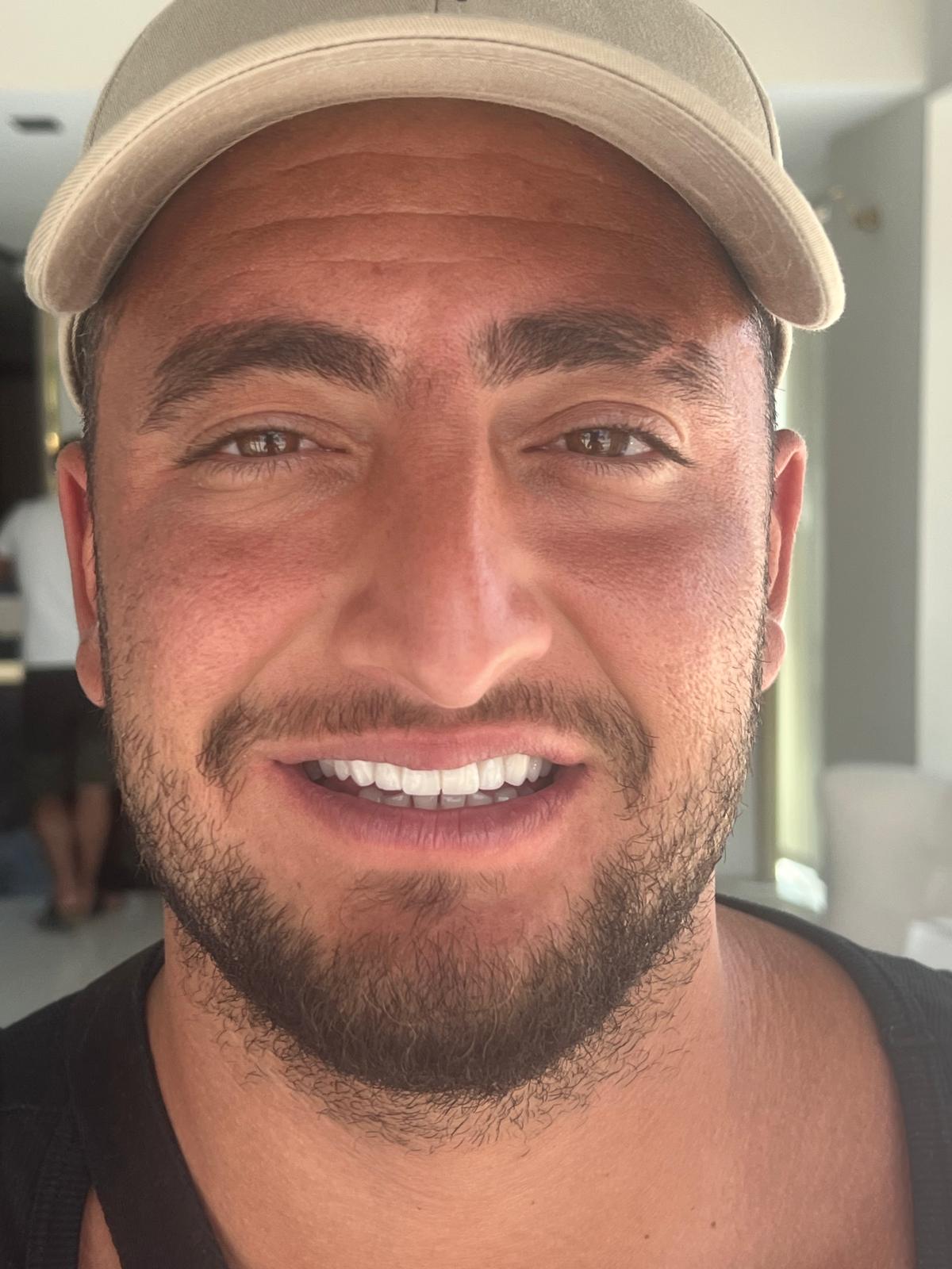 ECE Dental Patient Transformation